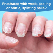 ROZINO 3 Days Nail Care Treatment - Keratin & Amino Acid Formula, 16ml (3 Pack)