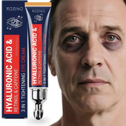 ROZINO 6% Caffeine Eye Cream with 1% Retinol & Hyaluronic Acid for Dark Circles & Wrinkles, 0.71 fl oz