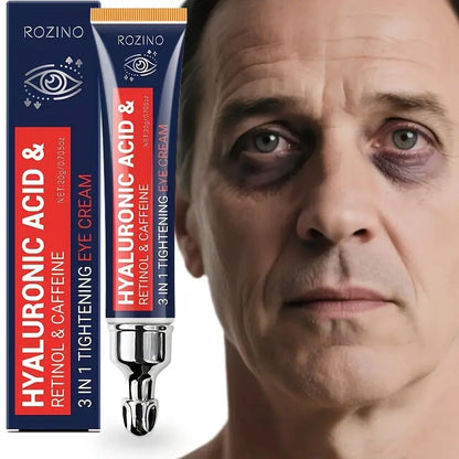 6% Caffeine Eye Cream for Dark Circles - Rapid Wrinkle Repair, Daily 1% Retinol & Hyaluronic Acid to Fight Fine Lines, Wrinkles, & Dark Spots, Eye Care Suitable for Men and Women's 0.71 fl. oz