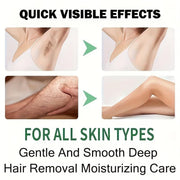 Rozino Coconut Oil Hair Removal Cream - Mild Formula for Sensitive Skin, 100g
